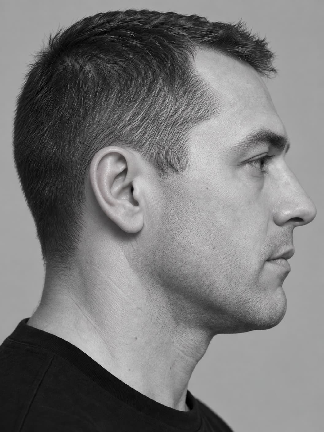 Monochrome side-profile portrait with a natural, healed ear contour against a neutral gray background